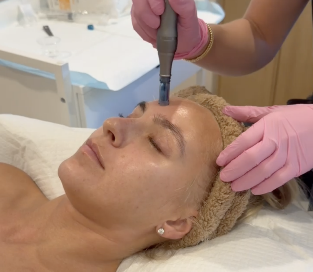 Best microneedling in Fort Lauderdsle at Fusiuon Wellnes Center